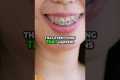 Your Mouth Health Impacts Your ENTIRE 