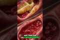 Berberine vs. Metformin: Surprising