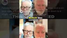 Black Seed Oil: The Ancient Supplement That Tastes Like Motor Oil #shorts