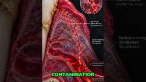 Bleeding Gums and Heart Health Risks #shorts