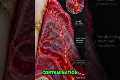 Bleeding Gums and Heart Health Risks